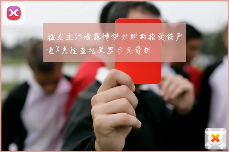 猛龙主帅透露博伊尔斯拇指受伤严重X光检查结果显示无骨折
